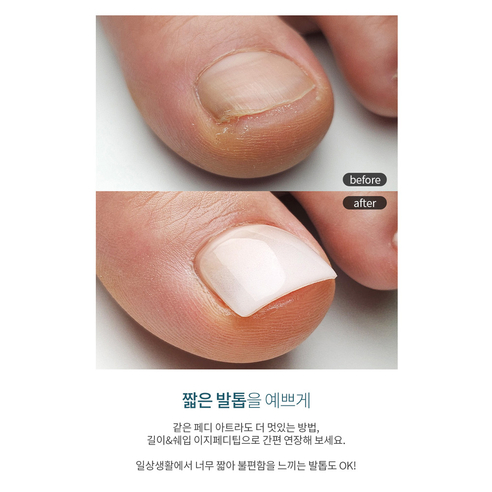 다이아미 착붙 이지 페디 팁 100pcs - 상세 이미지 5