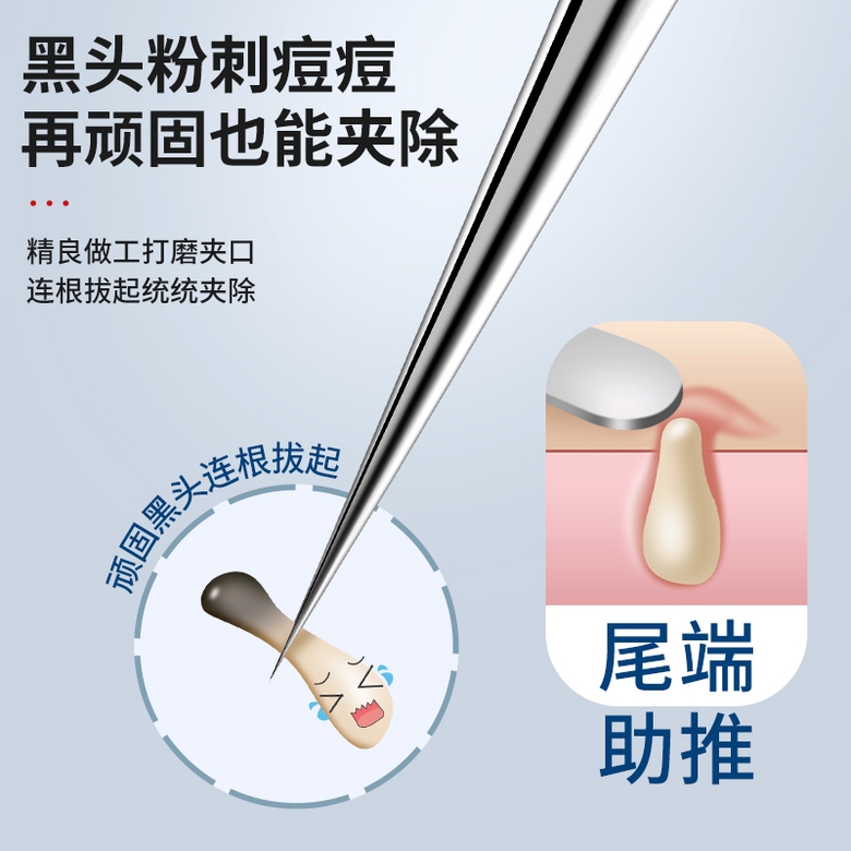 블랙헤드 제거 핀셋 여드름 압출기 정밀 미용도구 세트, 폐쇄성 여드름 관리용 스테인리스 트위저 세트 민트그린 6종 - 상세 이미지 4