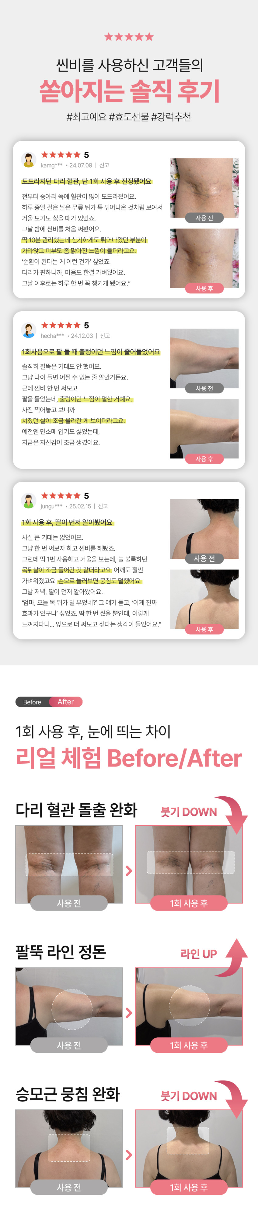 홈쎄라 씬비 EMS마사지기 바디마사지기 슬림 팔다리 종아리 복부 탄력 디바이스 판매처 상세 정보 이미지 1