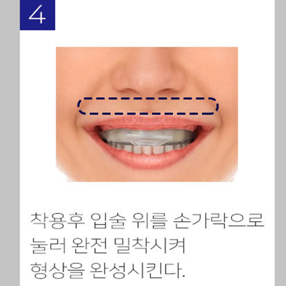 이갈이마우스피스 잘때장치 치아보호대 마우스가드 이악물기방지 이빨 - 상세 이미지 5