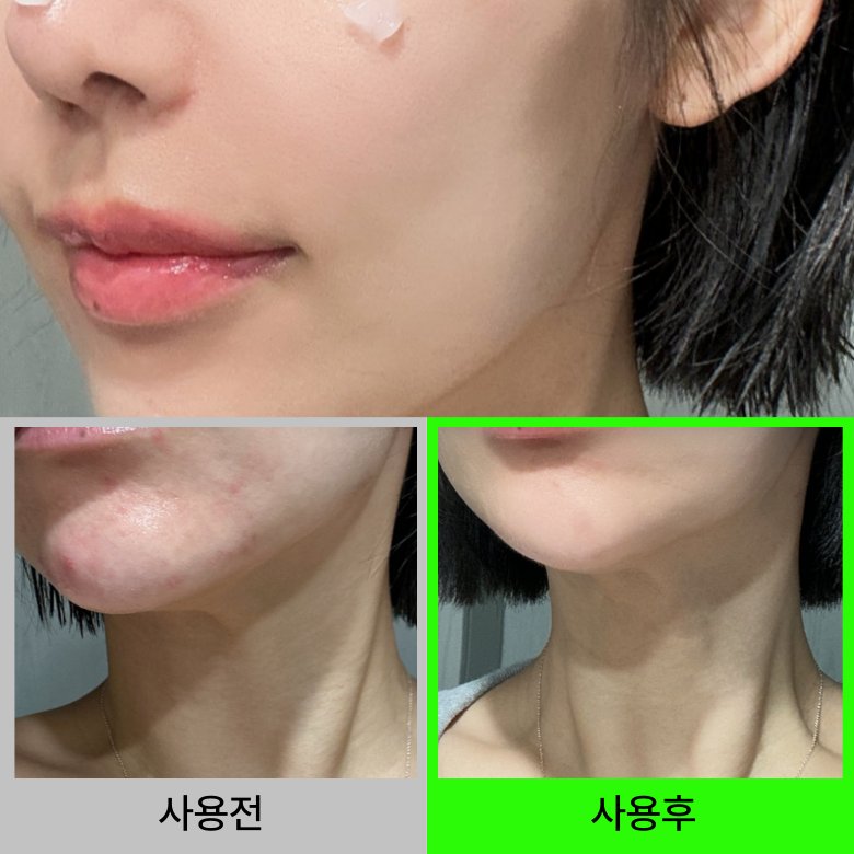 더마에스씨 센텔라시카크림 요철크림 좁쌀 오돌토돌 피부결 진정 시카 민감피부 50g 이미지 2