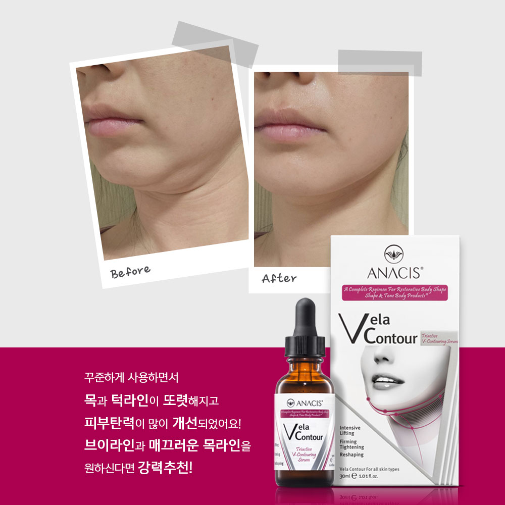 벨라컨투어 울트라 얼굴붓기 이중턱 턱살 턱선 리프팅 브이라인 밴드 땡기미 - 상세 이미지 2