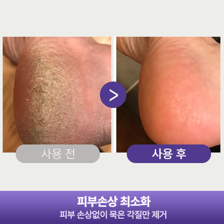 패디플래너 PRO세트 발관리 키트 풀리오본사 구매가이드