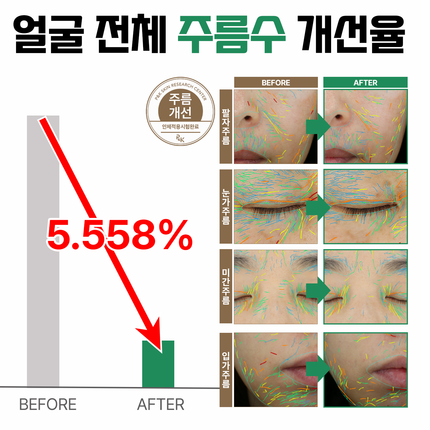 미와비 EGF 재생크림 피부과 점뺀 후 레이저 관리 콜라겐 피부 장벽 팔자 주름 개선 크림 - 상세 이미지 2