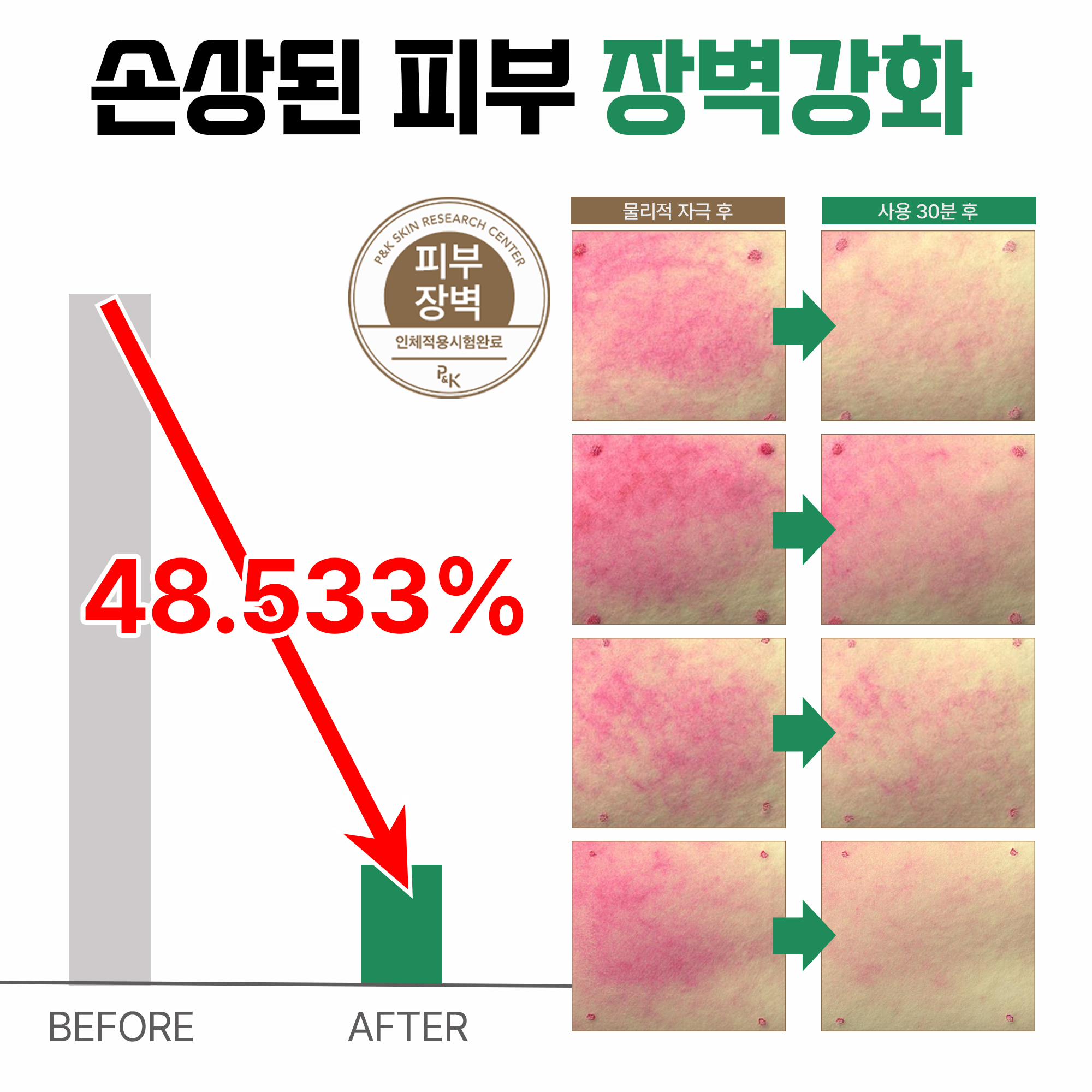 미와비 EGF 재생크림 피부과 점뺀 후 레이저 관리 콜라겐 피부 장벽 팔자 주름 개선 크림 - 상세 이미지 3