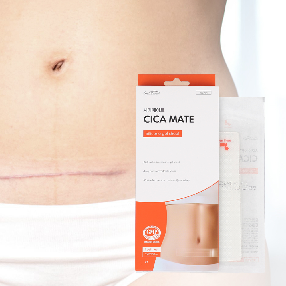 시카메이트 시카 흉터 밴드 패치 3x15 겔 케어 실리콘 시트 제왕절개 켈로이드 관리 화상 제품 이미지