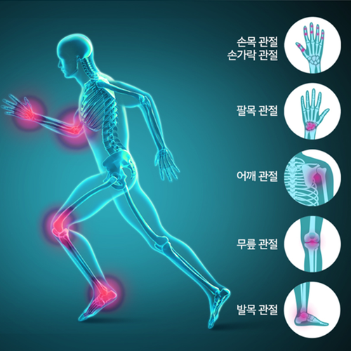 김소형원방 N 아세틸 글루코사민 60환 2박스 4개월 NAG 관절보환 관절 연골 건강 무릎 - 상세 이미지 4