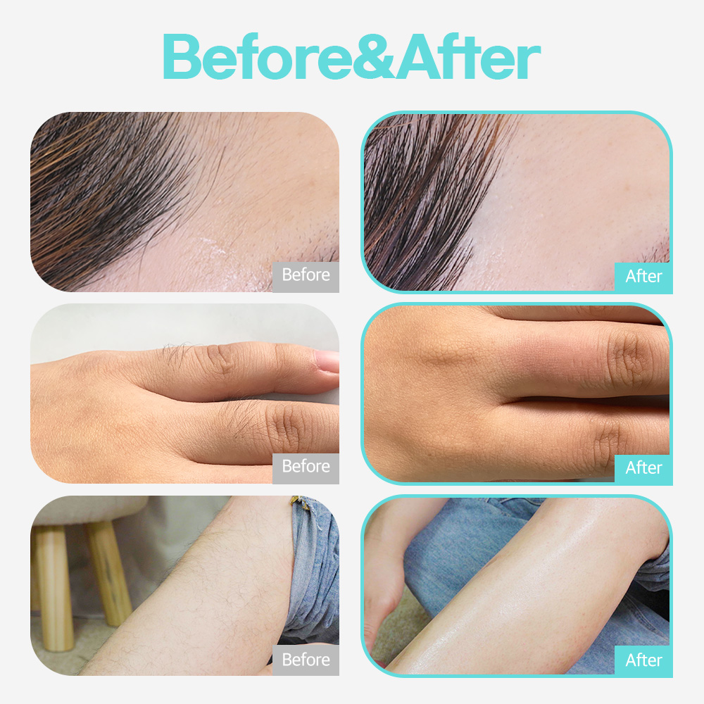 알롱 셀프 왁싱 슈가링 왁스 300g 비건 슈가 왁싱 키트 비키니 브라질리언 여자 남자 항문 수염 겨드랑이 바디 제모 크림