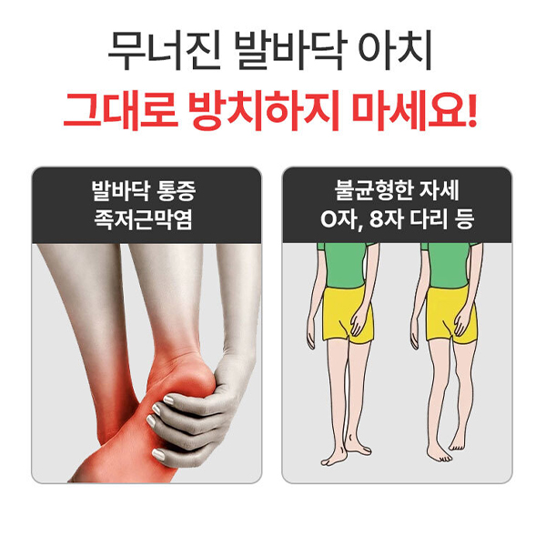 1+1 찌릿찌릿 발통증 잡아주는 아치형 깔창 아치 보조 평발 운동화 신발 발바닥 발통증 오다리 - 상세 이미지 4