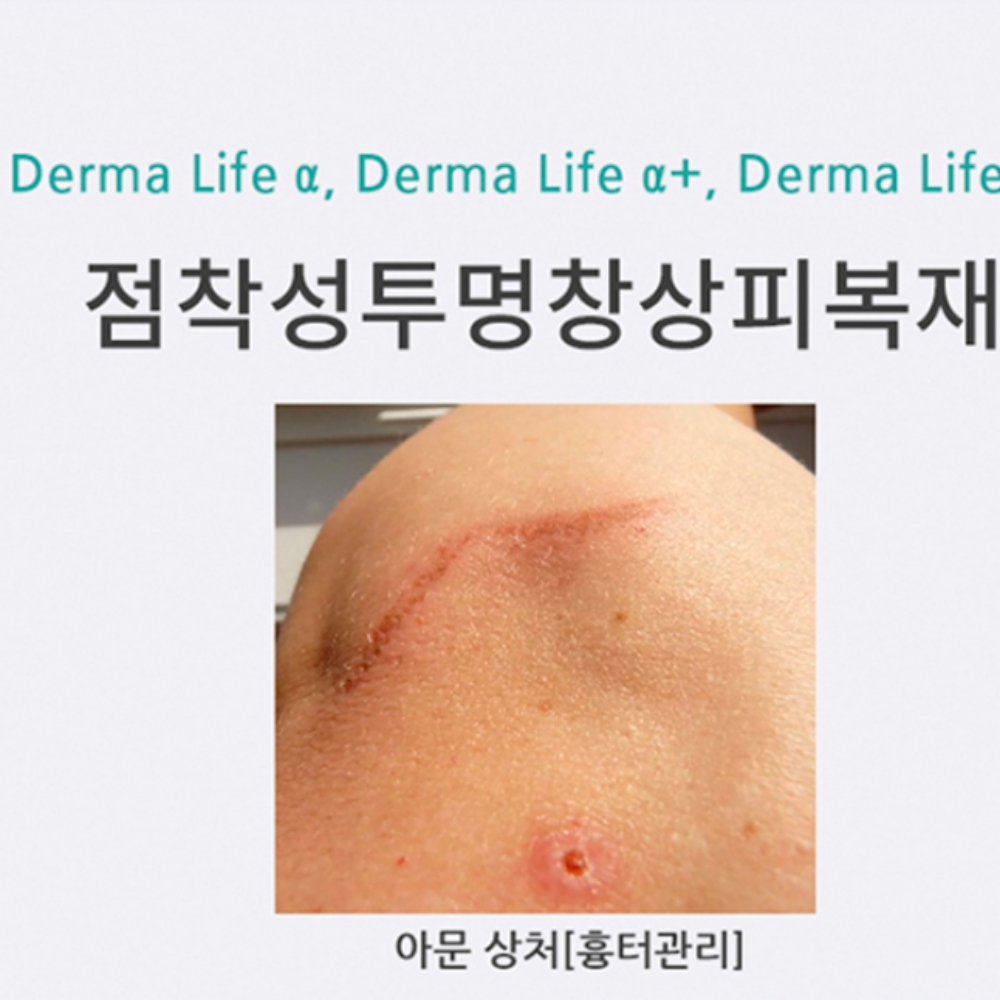 수술 흉터제거연고 제왕절개 연고 켈로이드 상처 이미지 7