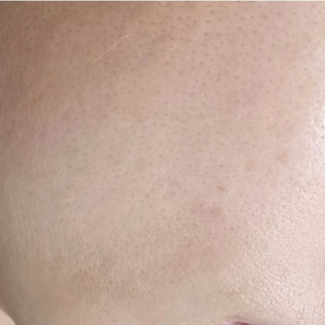 아리더마 해초필링스피큘 PDRN 모공 속건조 색소침착 재생 트러블 각질 2개월 풀세트 - 상세 이미지 4
