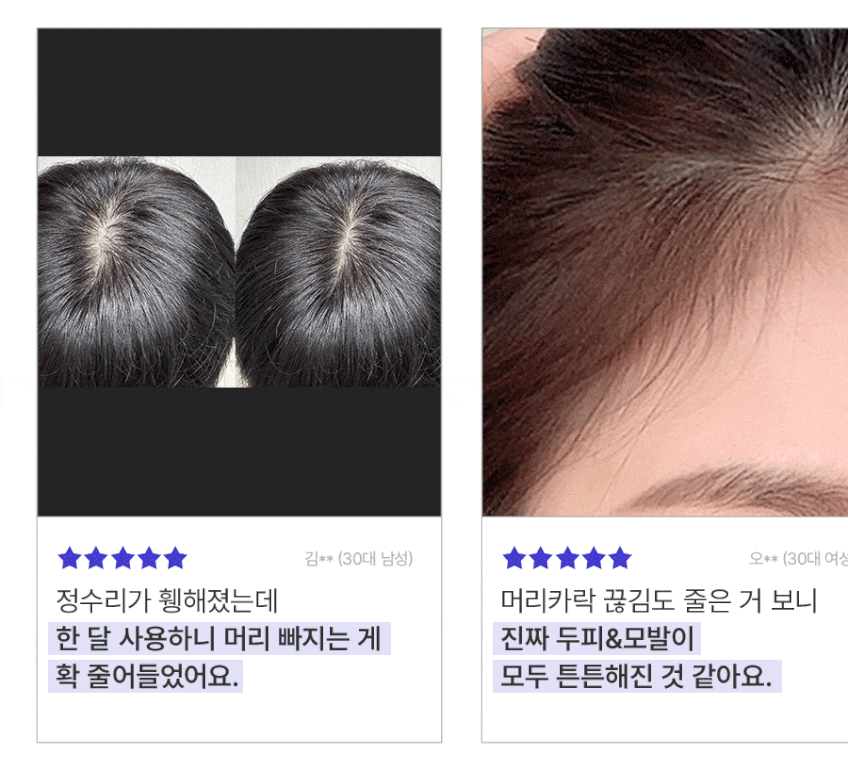 에센풀 헤어 샴푸 (2개) 미용실 샴푸 탈모완화 약산성 샴푸 추천 판매처 상세 정보 이미지 3