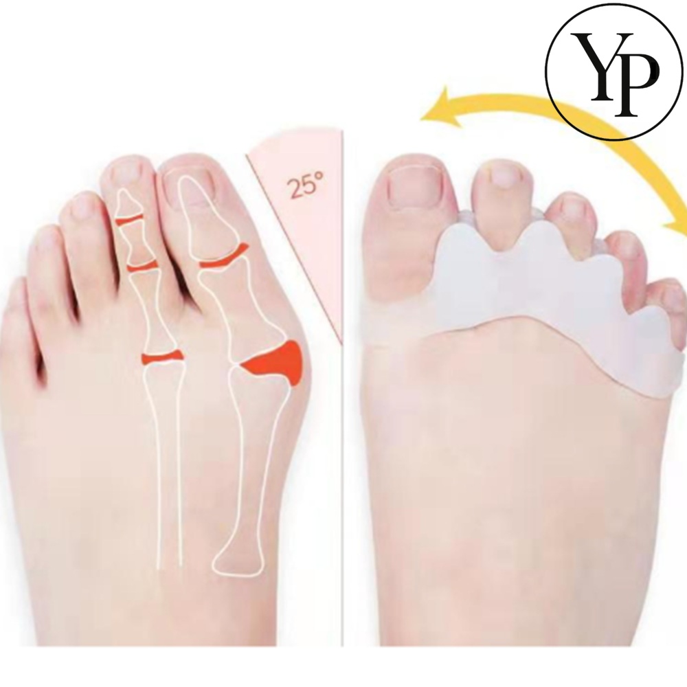 발가락 교정기 사이 벌리기 공간 만들기 실리콘 링 스트레칭