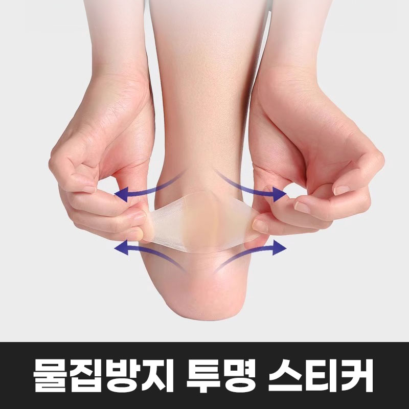 [까짐방지] 애니윙 발꿈치 보호밴드 물집방지 겔 방수 스티커 - 상세 이미지 2