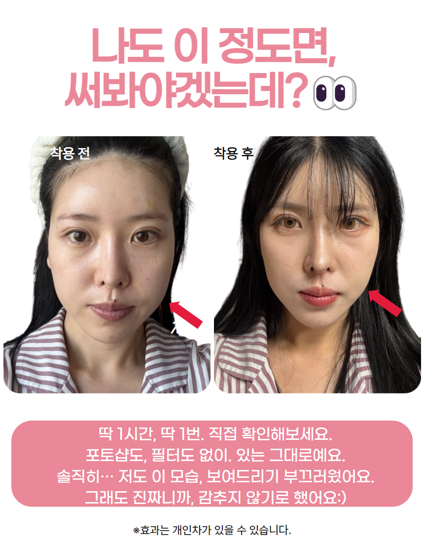 에이리드 리프팅밴드 브이라인 얼굴축소 불독살 팔자주름 얼굴 압박 이중턱 땡김이 모찌밴드 - 상세 이미지 2