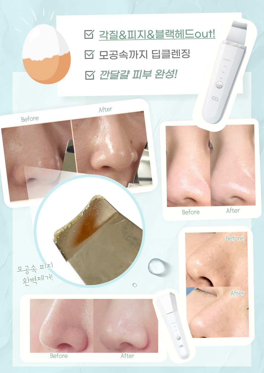 오아 아쿠아 필링기 갈바닉 마사지기 각질 블랙헤드 피지제거기 워터필링기 삭피기 스킨스크러버 상세 이미지 8