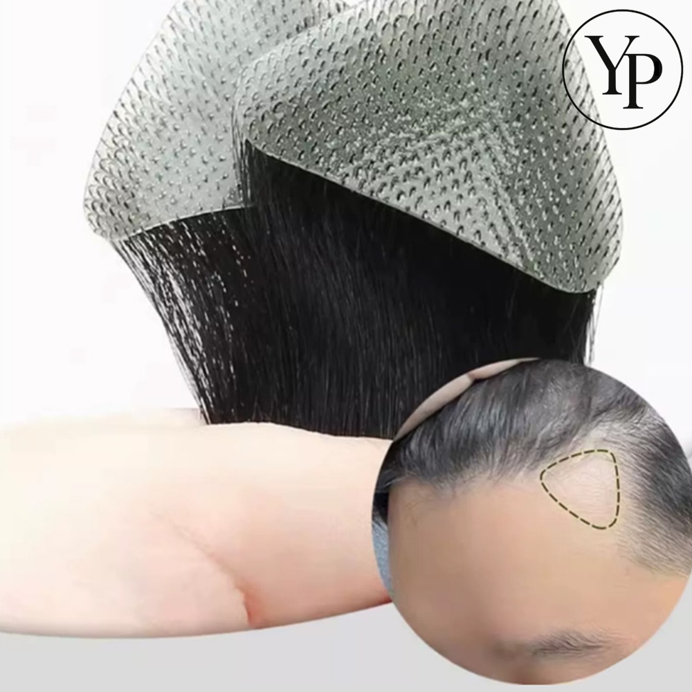 남자 부분 가발 엠라인 헤어패치 뒷머리 커버 붙임머리 탈모 피스 - 상품 이미지