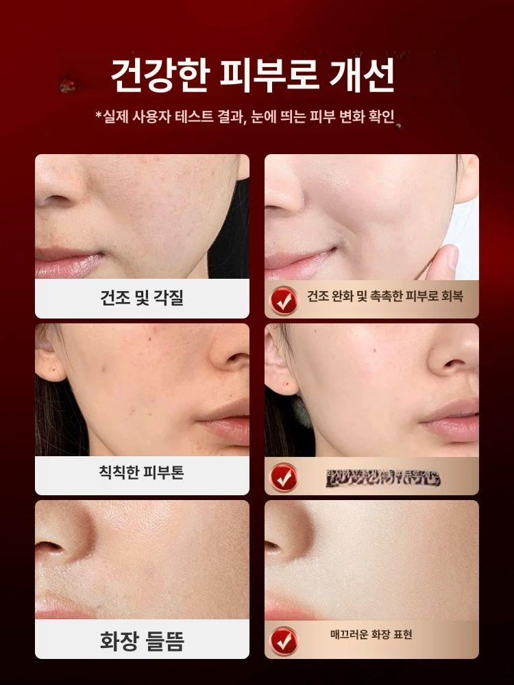 관리실 앰플 분사기 습기 모발 스프레이건 수분 1단계 ABS 핑크 단용기 360KPA - 상세 이미지 3
