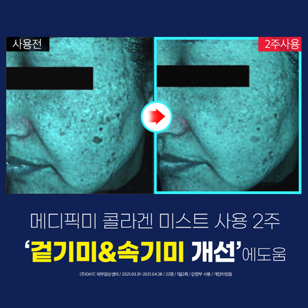 콜라겐 88메디픽미 트라넥PDRN 고체 젤리 미스트세럼 잡티 리프팅 주름 105ml, 2개 이미지 8