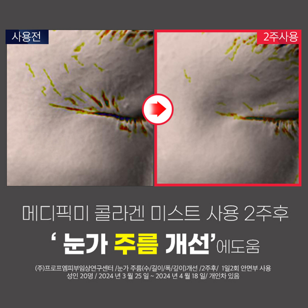 콜라겐 88메디픽미 트라넥PDRN 고체 젤리 미스트세럼 잡티 리프팅 주름 105ml, 2개 이미지 6