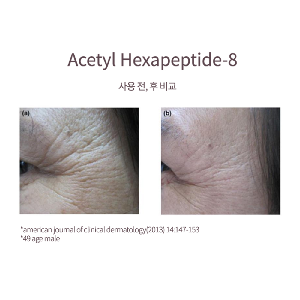 [1+1+1] 맥퀸뉴욕 프랑스산 100% 콜라겐 링클 멀티밤 10g /팔자주름 리프팅 미간주름 노화 건조 눈가주름 보습 - 상세 이미지 3