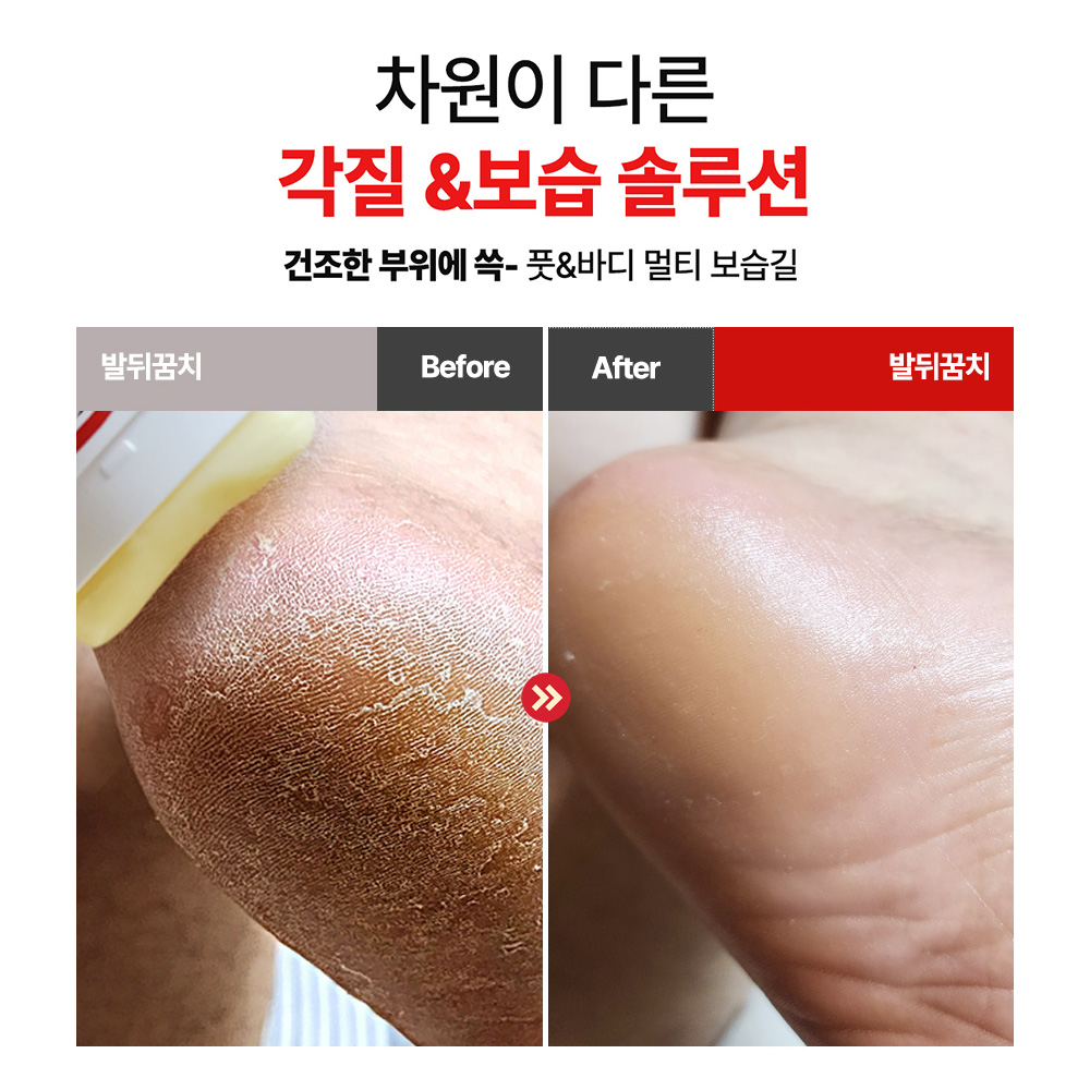 식물성바세린+시어버터 풋크림[메디픽미]시어세린 버터스틱밤 발보습 발뒷꿈치 시트러스, 20g, 1개 이미지 6