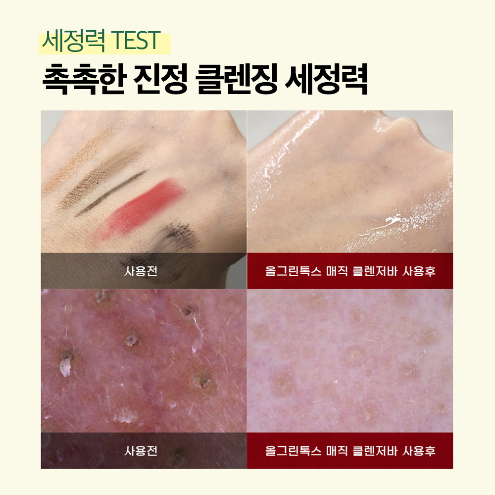 약산성 병풀 메디픽미 올그린톡스 클렌징바 피지 모공 살리실산 저자극 비누 90g, 1개 - 상세 이미지 4
