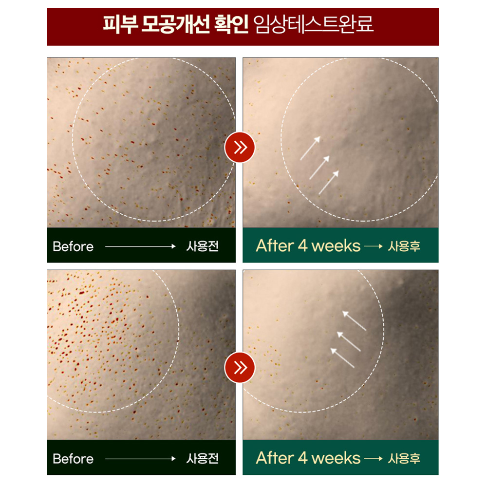 민감피부 시카 케어  메디픽미 올그린톡스 솔루션 병풀 토너150ml피지 유분 모공 바하 스킨 - 상세 이미지 4