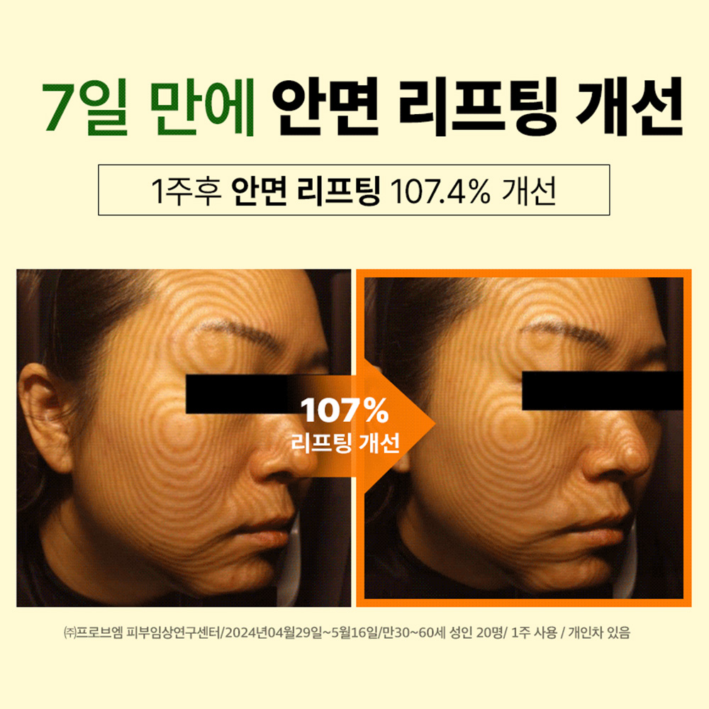 메디픽미 멜라베논 비타에너지 앰플세트 이데베논 잡티관리 주름 리포좀비타민 23ml, 1개 이미지 8