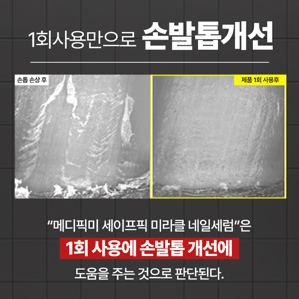 손발톱영양제 메디픽미 세이프픽 미라클 네일세럼 문제성 발톱 강화제 17ml, 1개 이미지 6