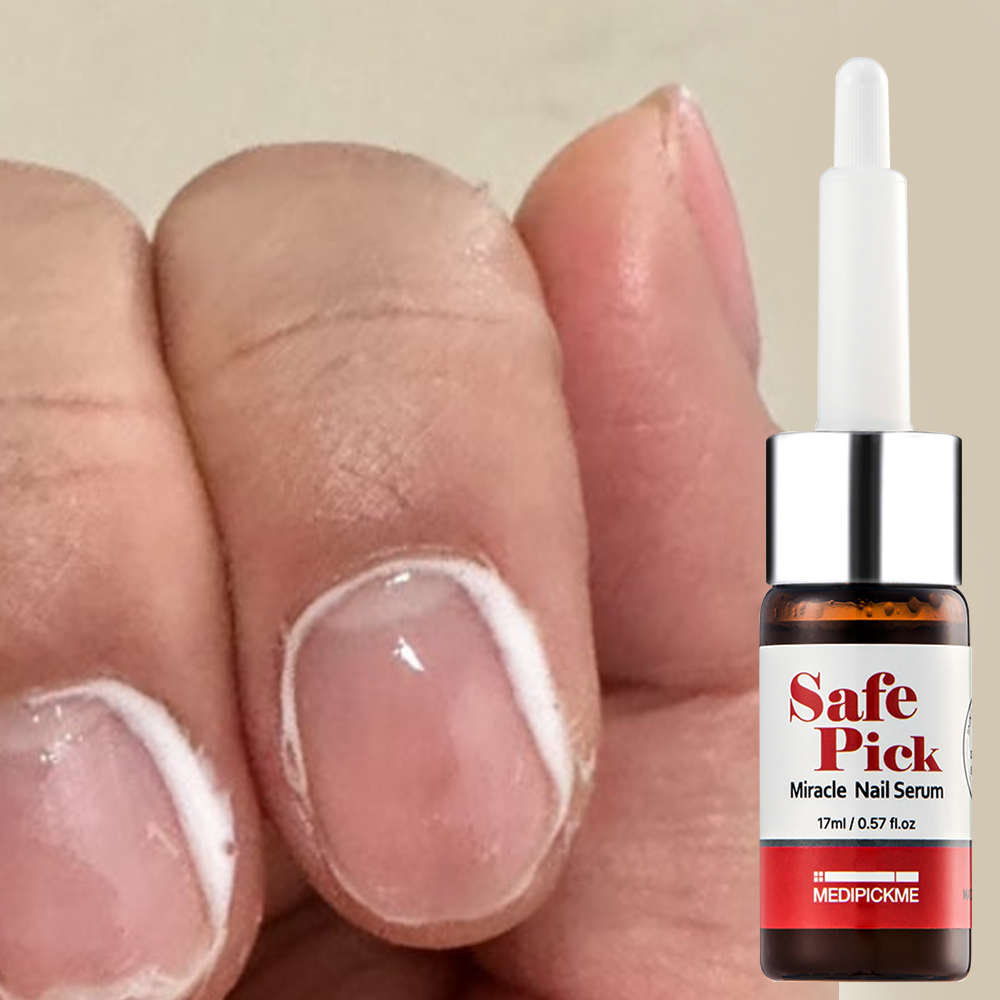 손발톱영양제 메디픽미 세이프픽 미라클 네일세럼 문제성 발톱 강화제 17ml, 1개 - 상세 이미지 4