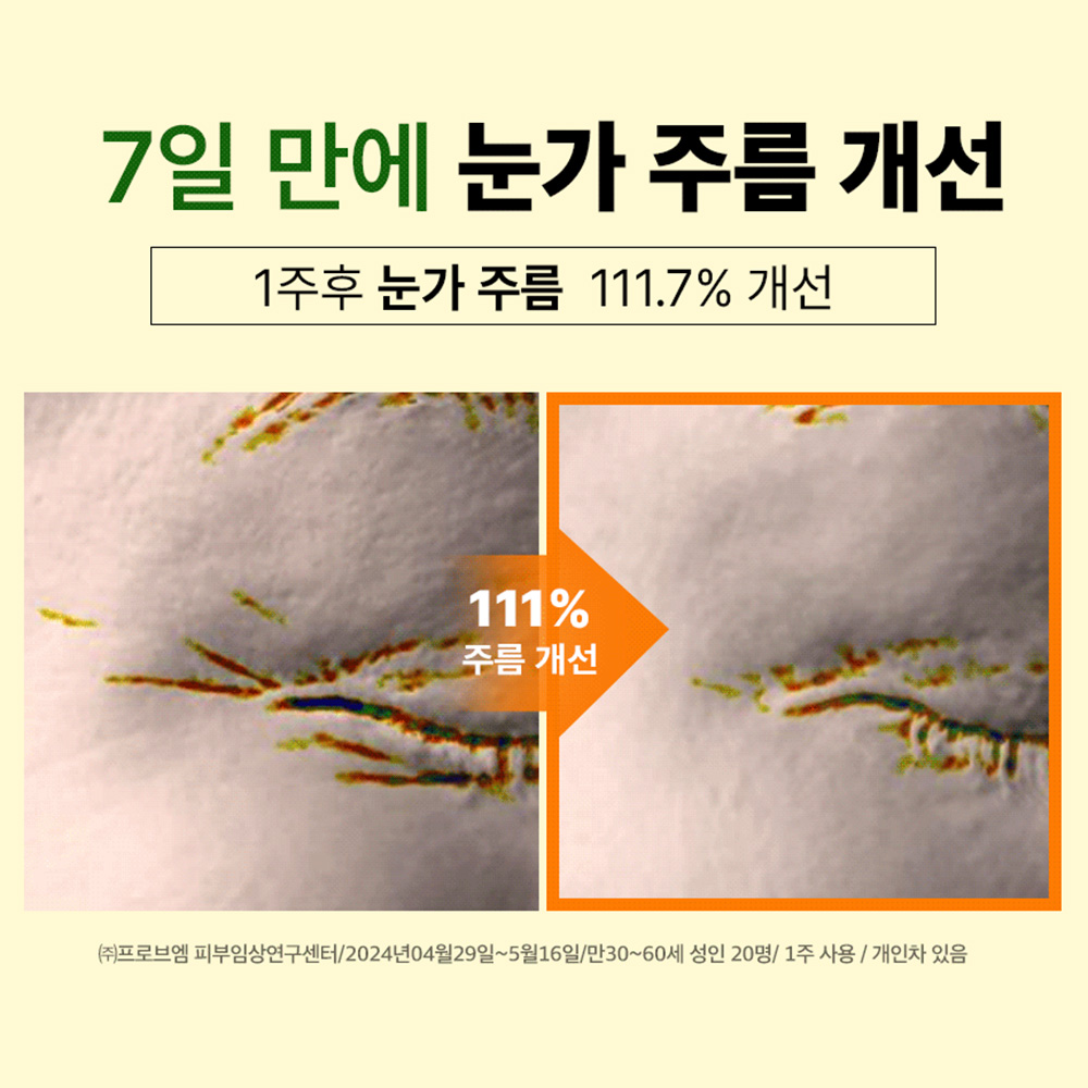 메디픽미 멜라베논 비타에너지 앰플세트 이데베논 잡티관리 주름 리포좀비타민 23ml, 1개 이미지 6