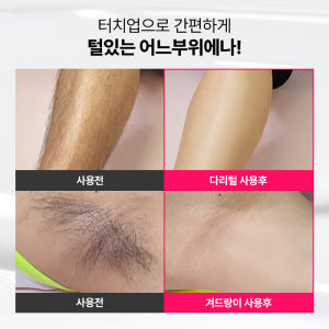 제모크림 메디픽미 터치업리무벌 크림 다리털 겨드랑이 비키니라인 비키니라인... 솔직 후기 | 피부 타입별 분석 - 상품 이미지 2