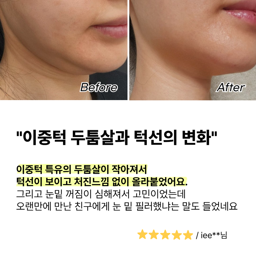 고주파 마사지기 얼굴 갈바닉 뷰티 디바이스 사용후기 선택법