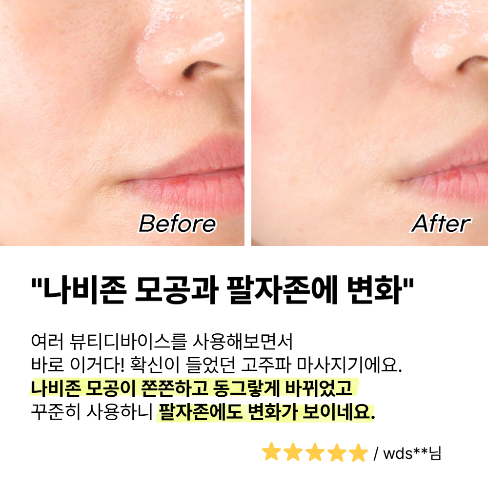 고주파 마사지기 얼굴 갈바닉 뷰티 디바이스 사용후기 선택법