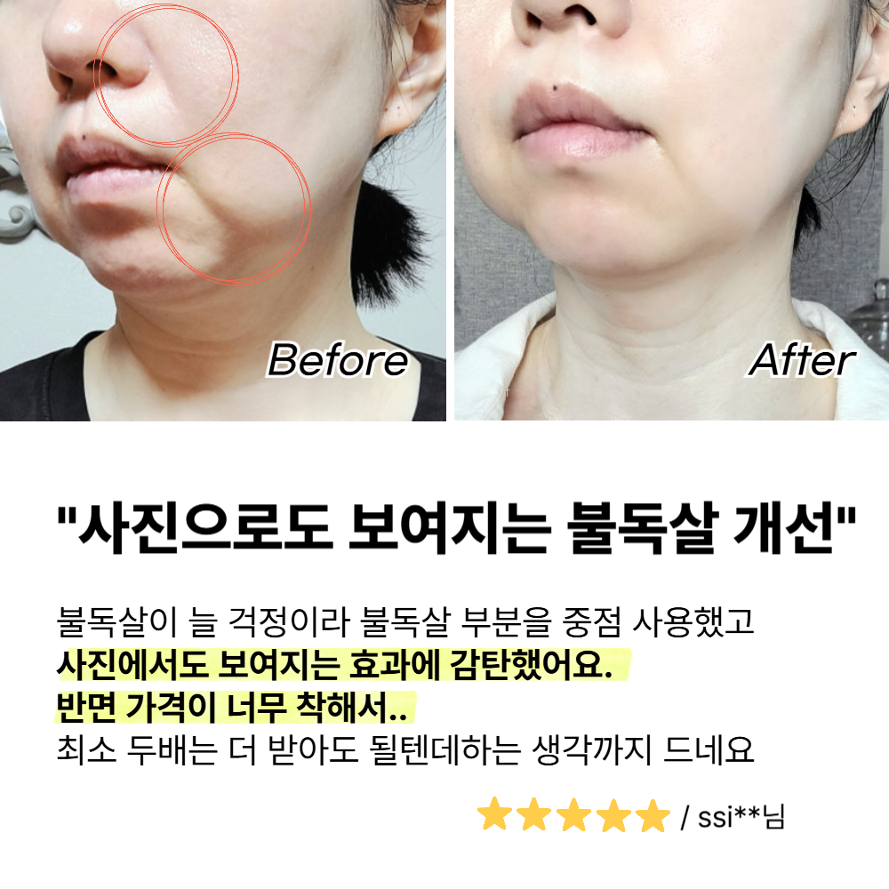 고주파 마사지기 얼굴 갈바닉 뷰티 디바이스 사용후기 선택법