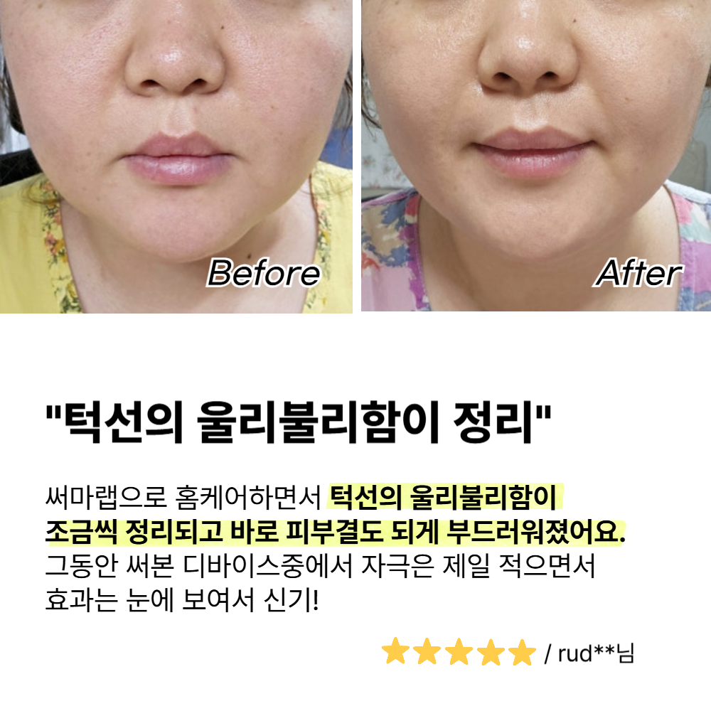 고주파 마사지기 얼굴 갈바닉 뷰티 디바이스 사용후기 선택법