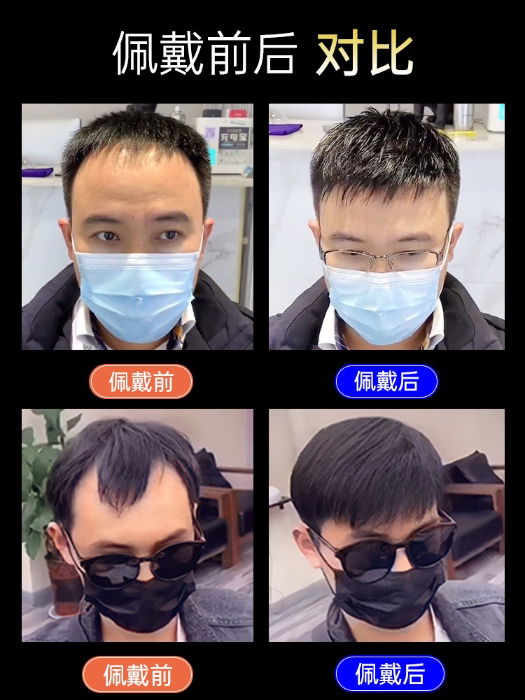 남자앞머리가발 정수리 윗머리 앞머리가발 남자 - 상세 이미지 2