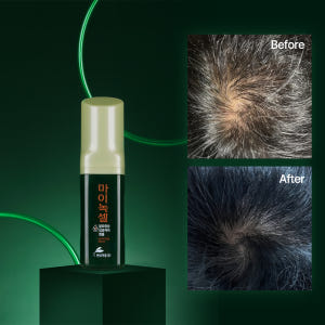 현대약품 마이녹셀 스칼프 인텐시브 탈모앰플 60ml, 2개 솔직 후기 | 피부 타입별 분석 - 상품 이미지 2