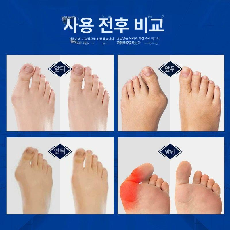 실리콘 발가락 교정기 내성발톱 발 보호 교정구 화이트 - 상세 이미지 3