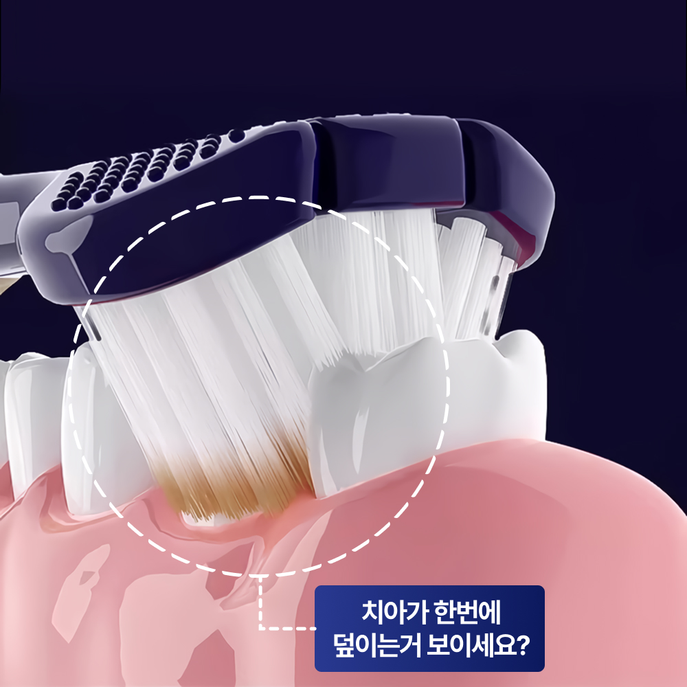 덴티넘 삼타칫솔 3면칫솔 - 상세 이미지 5
