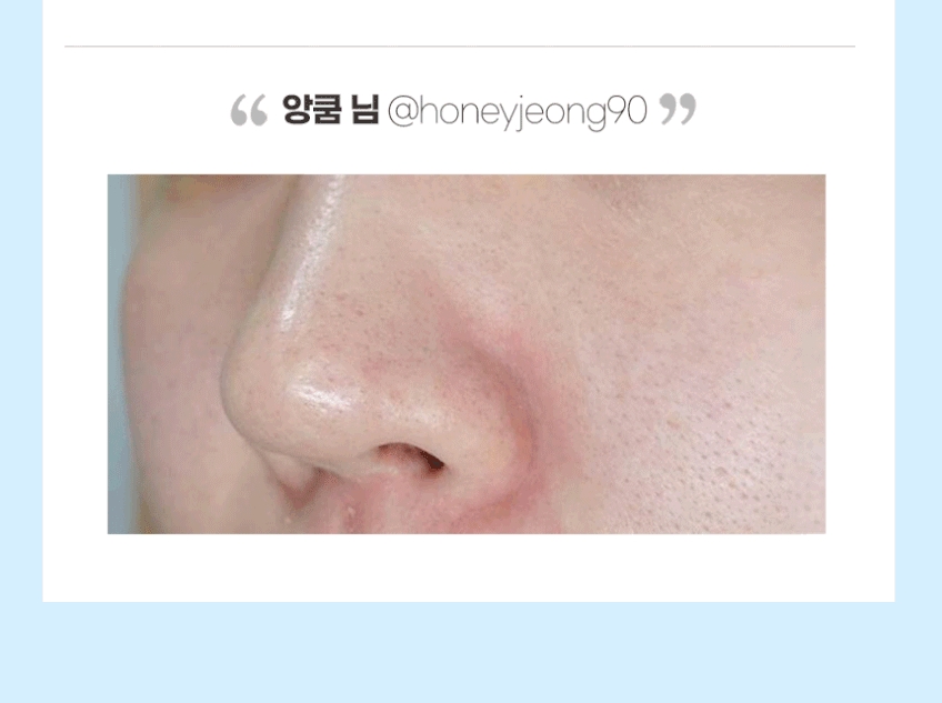 라피타 수소 아쿠아 워터필링기 피지흡입기 각질관리 JOC-H2 판매처 상세 정보 이미지 4