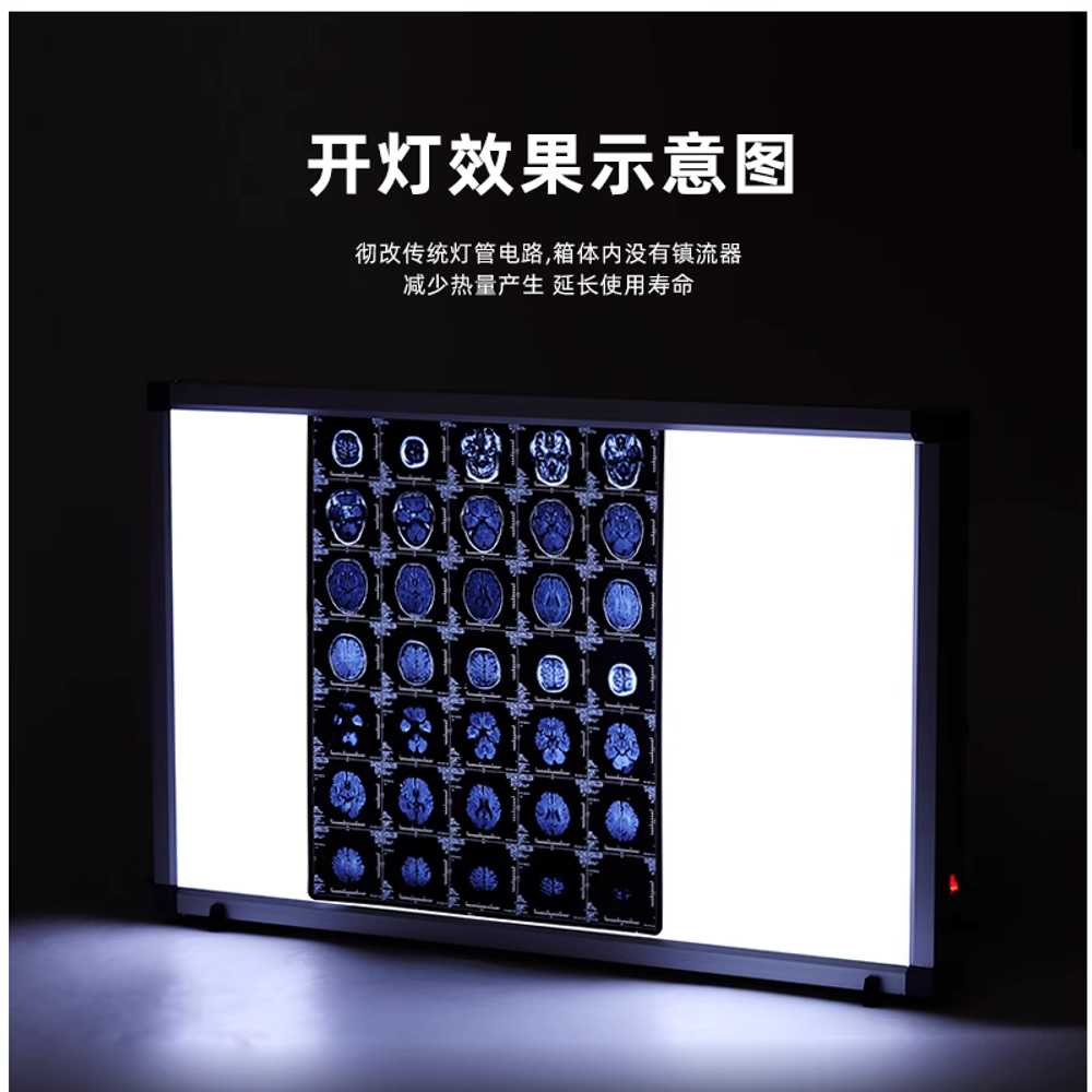 엑스레이 뷰어 방사선 필름 판독기 조명 보드 반사판 표준형 LED 소형 - 상세 이미지 3