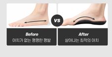 이봉주 아치 깔창 아치본 핀 스본 본 족저근막염 무지외반증 오다리 솔루션 M L - 상세 이미지 5