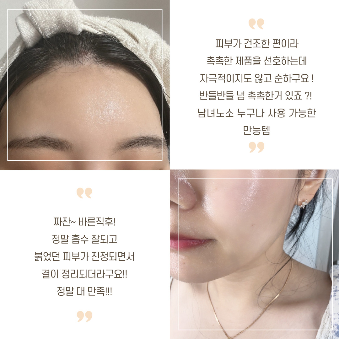 마담미쉘 베르베린 알로에베라 알로에 수딩젤 퓨어 겔 400g 피부진정 사용법 이미지 8