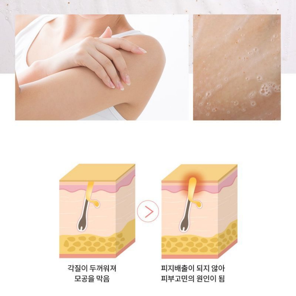 브라질리언 왁싱 팔꿈치 스크럽 임산부 바디 스크럽 이미지 8