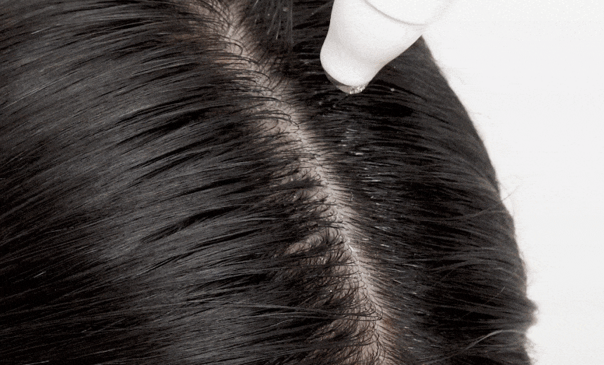 VIVELAB Revive Therapy Hair Scalp & Brow Ampoule - description 17