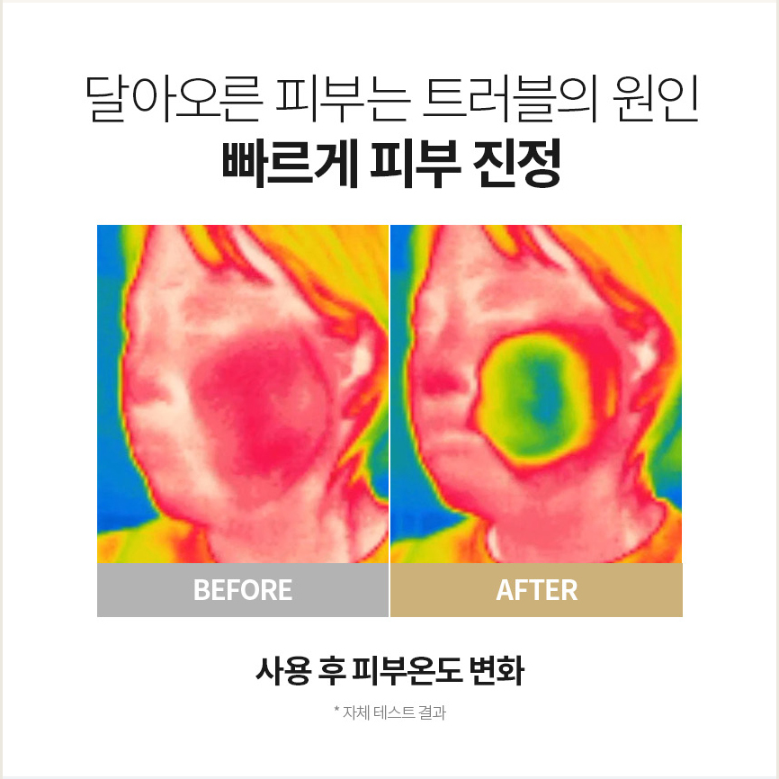 일초픽 감자로션 200ml - 상세 이미지 3