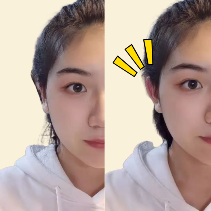 누운귀 테이프 60P 요정 엘프 귀 교정 세우는 필러 스티커 뒤 리프팅 성형 뷰티 미용 - 상세 이미지 2