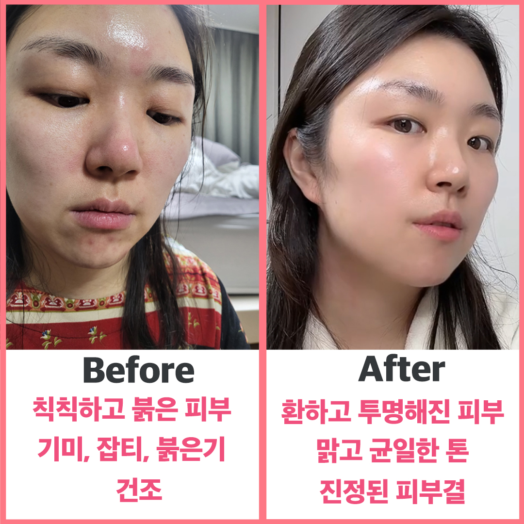 펄리 엑소좀 미백 모공 앰플 + 시카 물광 주름개선 수분크림 - 상세 이미지 2